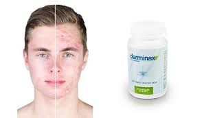 Derminax - cena - prodej - hodnocení - objednat