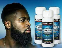 What is Minoxidil supplement - does it really work